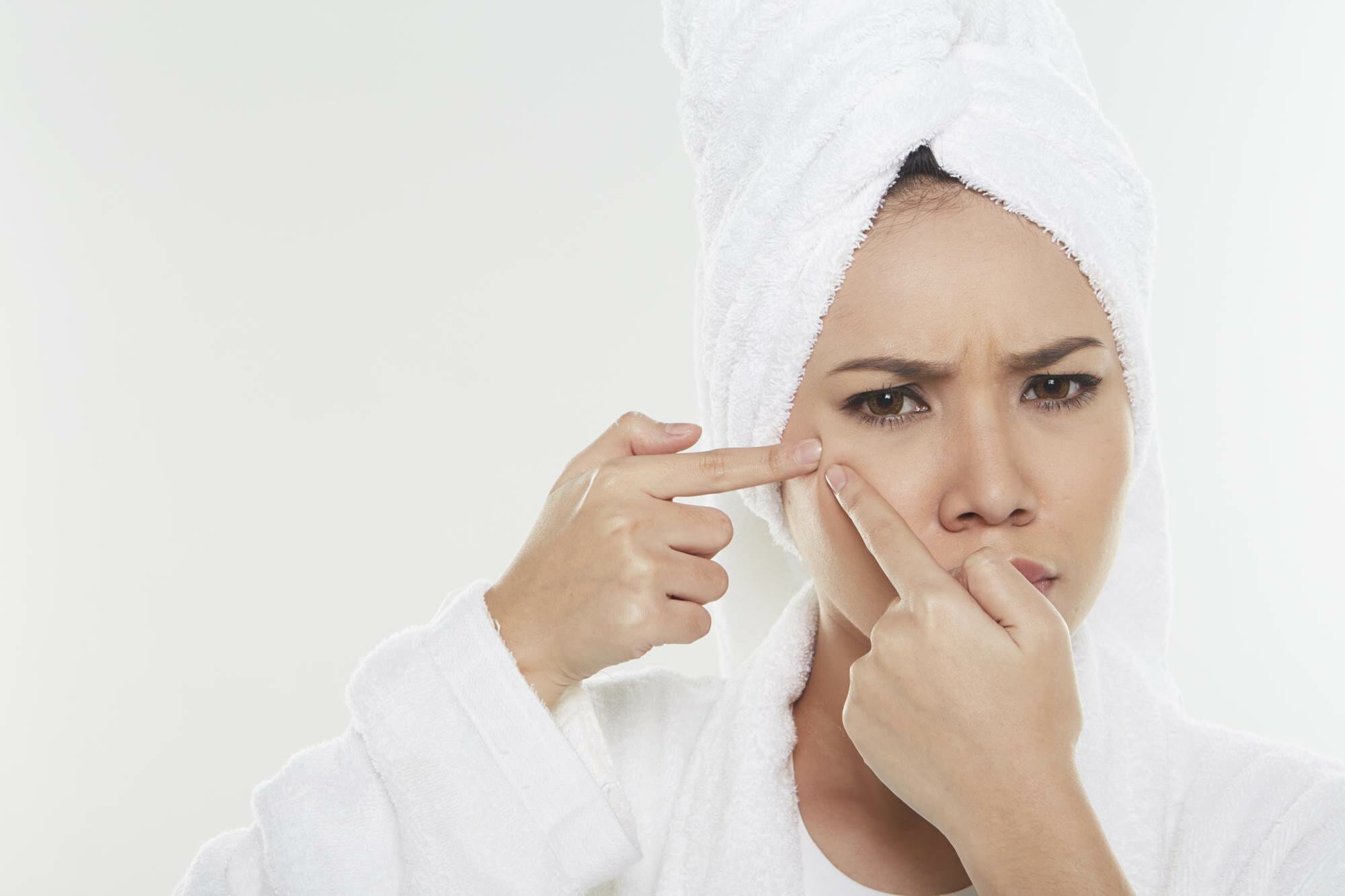 Acne Overview And Types - Merritt Island FL Acne Overview And Types - Merritt Island FL