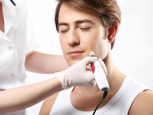 DP4 - Everything You Need to Know About Micro-Needling - Merritt Island FL