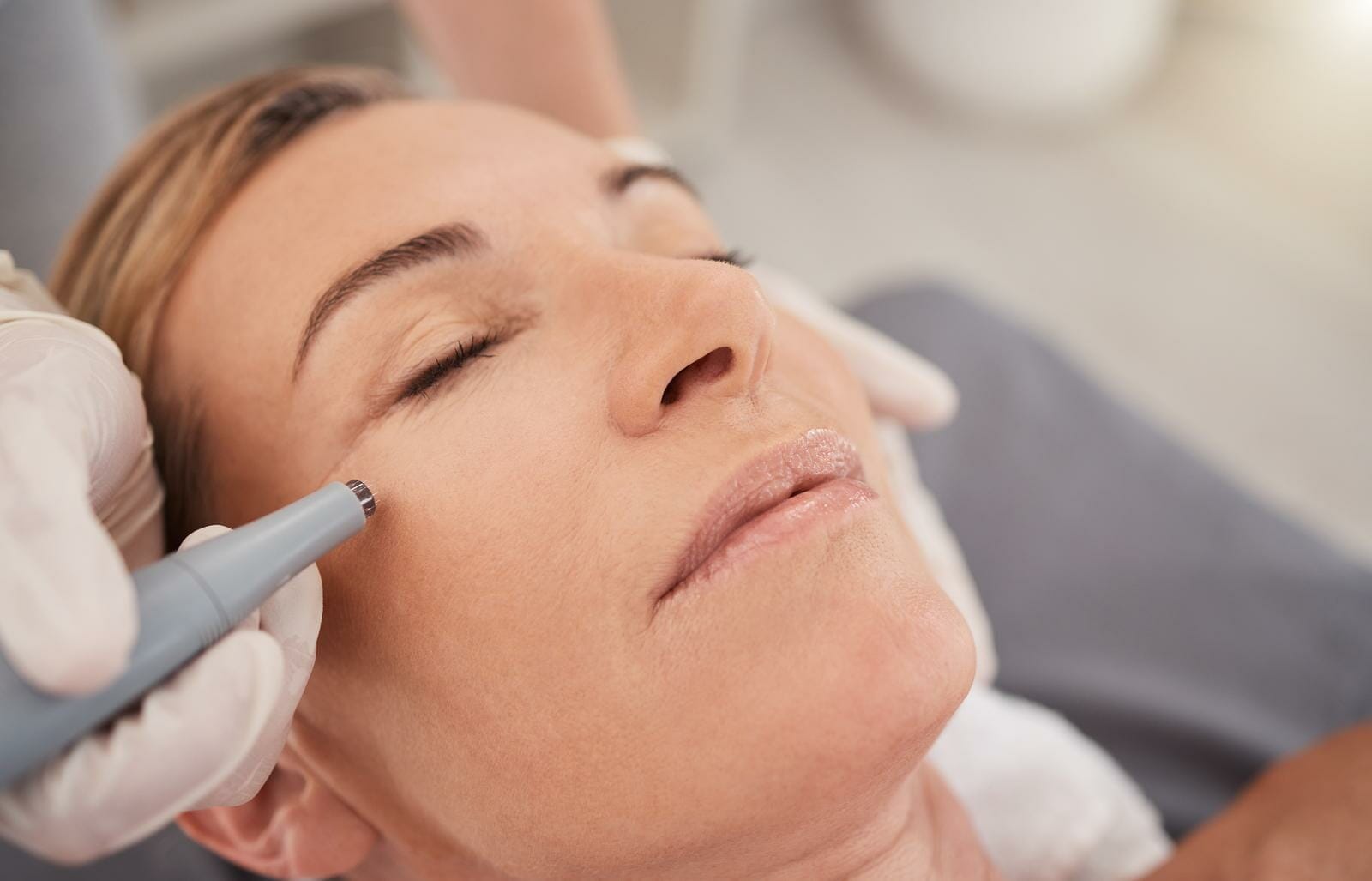 <strong>Introducing DP4 Microneedling: A Revolutionary Skin Revitalization Treatment</strong> - Merritt Island FL